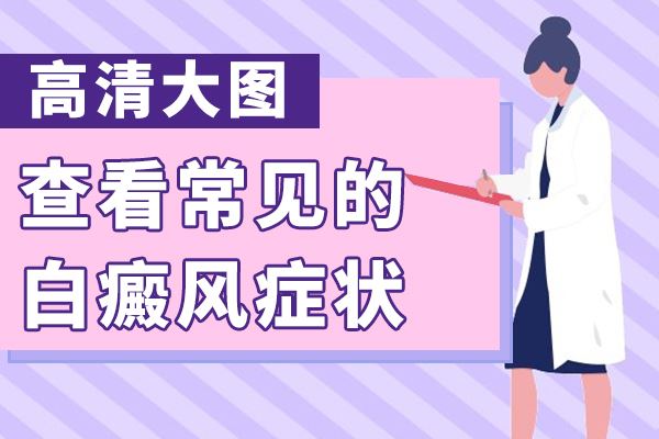 白癜风患者心理干预不可或缺，你心态健康吗?